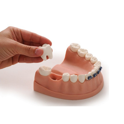 보건교육 치아관리모형(79229) 인체 치아비교 의료 학교 병원 교육기관
